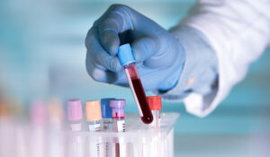 How to lower A1c