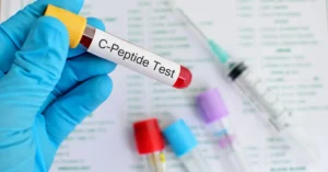 C Peptide Test