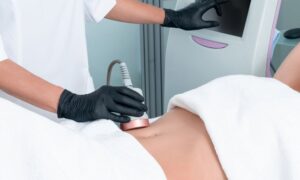 Ultrasound cavitation