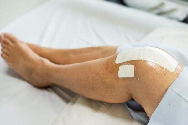 knee-transplant