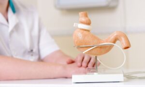 Who Should Undergo Gastric Banding Surgery