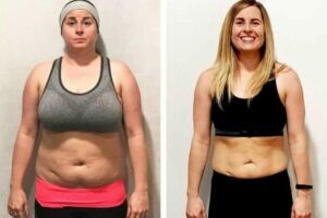 pcos before after head