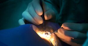 10 Cataract Surgery Precautions You Need to Know