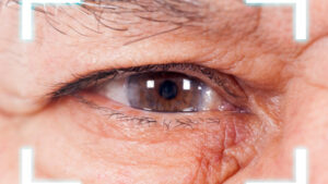 How Iris Hooks Can Help You With Your Cataract Surgery