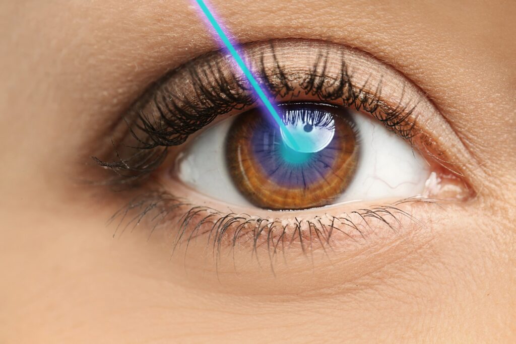 How to Treat LASIK Complications?