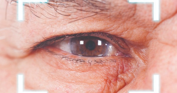 Complicated Cataract: What You Need to Know