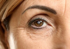 What Are Mild Cataracts?