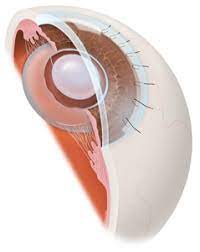 What Are The Benefits Of Intracapsular Cataract Extraction?