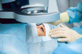 What Is Laser Cataract Surgery?