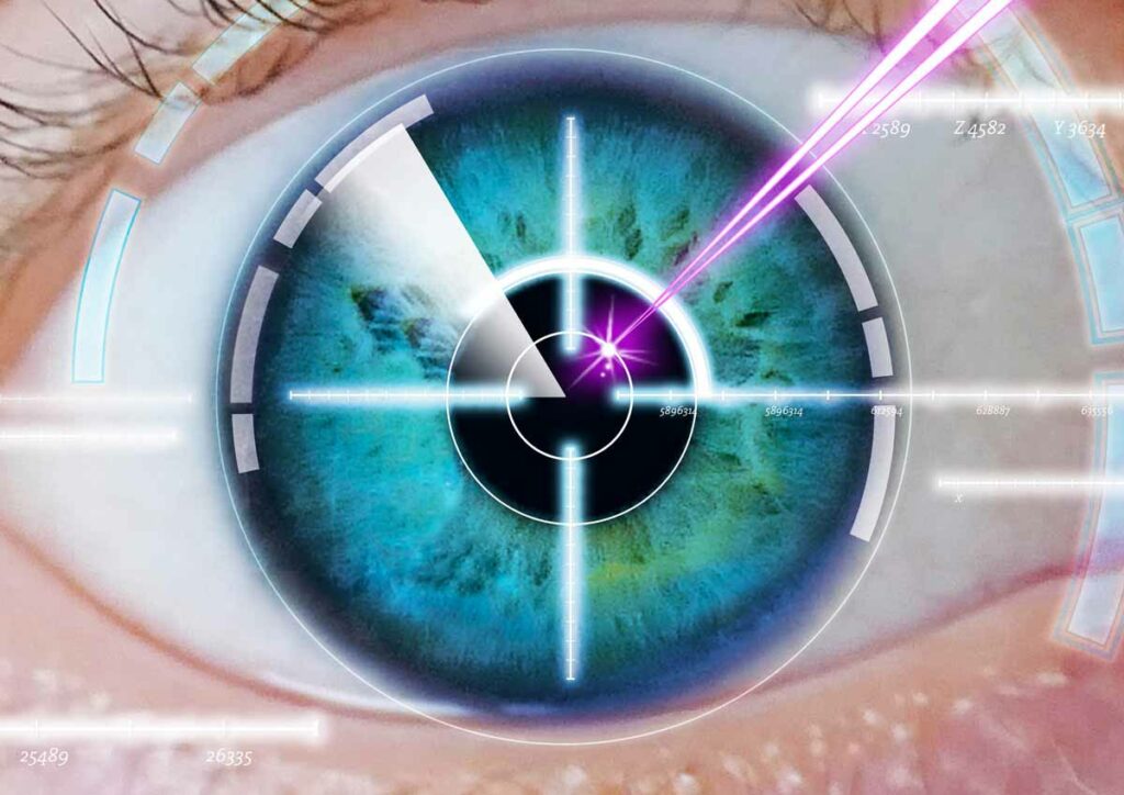 What Is Robotic Cataract Surgery: How It Works