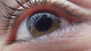 How Long Do Cataract Lenses Last?