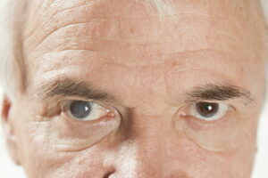 9 Warning Signs You Might Have Cataracts: How Can You Manage