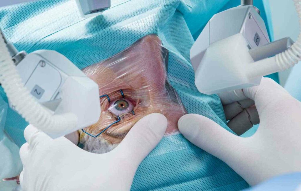 What Is Laser Cataract Surgery and How Can It Help You?