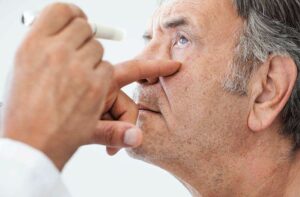 Sclerotic Cataract: What It Is and How to Treat It