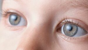 What Is A Congenital Cataract?
