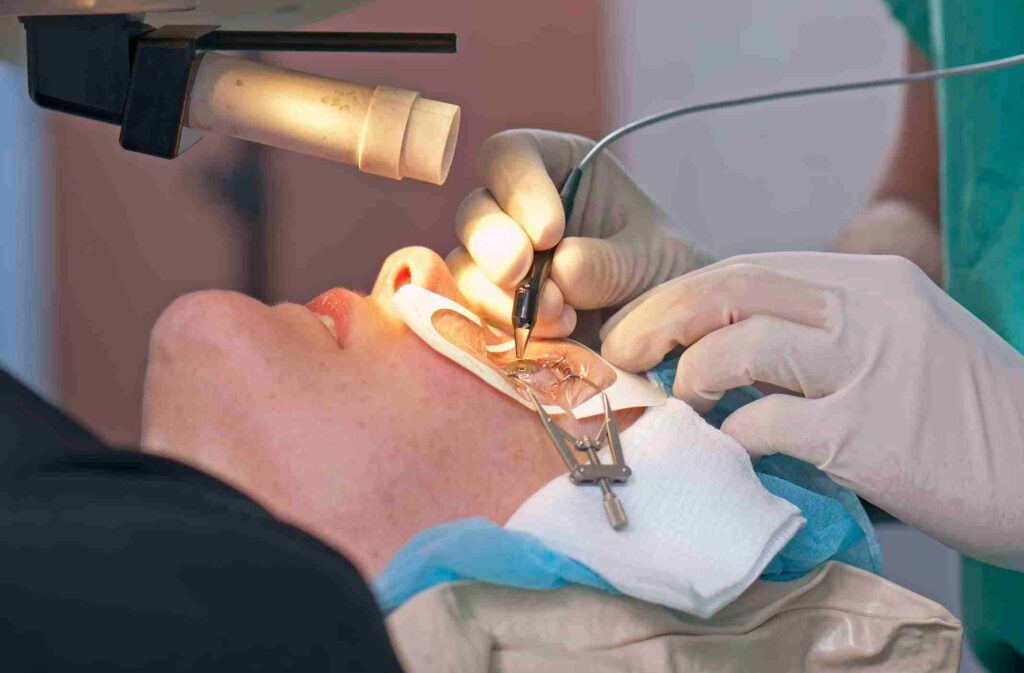 Lasik surgery