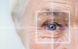 Blade LASIK: All About This Type of LASIK Surgery