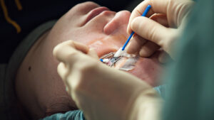 Cheap Lasik Surgery | Is LASIK Surgery a Cheap Surgery?