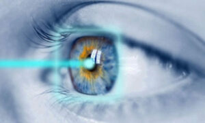 is laser eye surgery safe