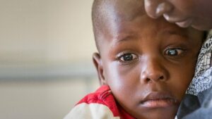 Are Cataracts Common In Children?
