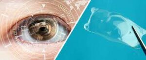 What Are LASIK and ICL?