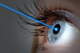 What is Lasik?