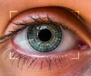 What Is Lasik Surgery?