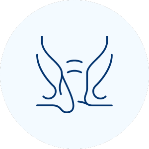 Fistula