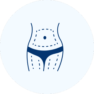 Liposuction