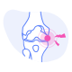 arthritis